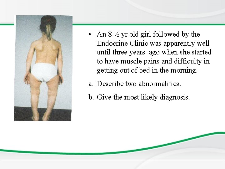  • An 8 ½ yr old girl followed by the Endocrine Clinic was