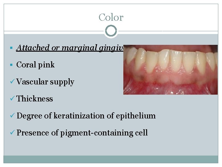 Color § Attached or marginal gingiva § Coral pink ü Vascular supply ü Thickness