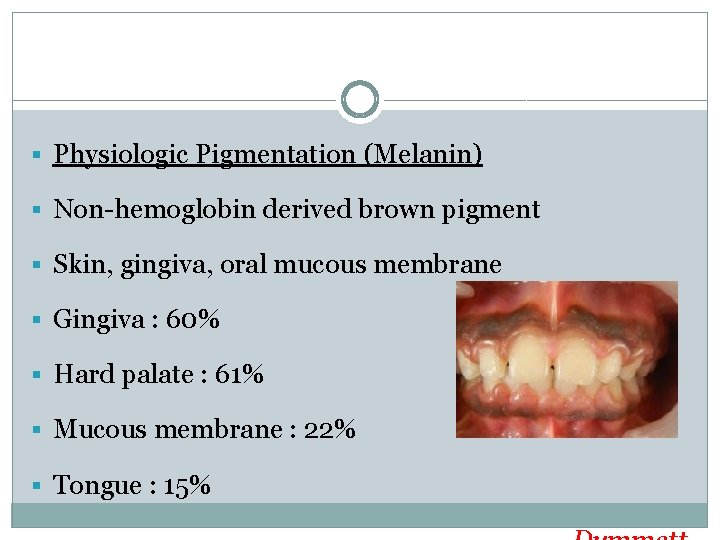 § Physiologic Pigmentation (Melanin) § Non-hemoglobin derived brown pigment § Skin, gingiva, oral mucous