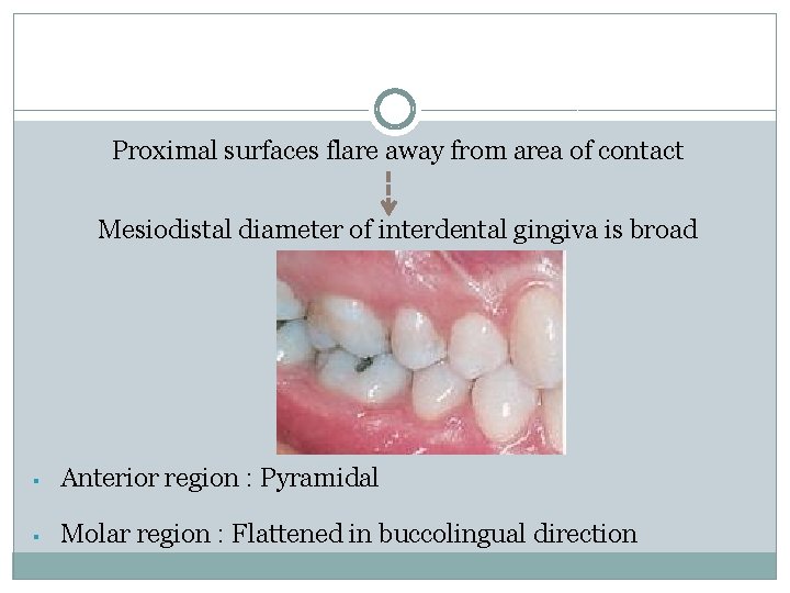 Proximal surfaces flare away from area of contact Mesiodistal diameter of interdental gingiva is