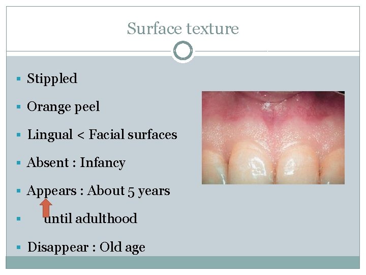 Surface texture § Stippled § Orange peel § Lingual < Facial surfaces § Absent