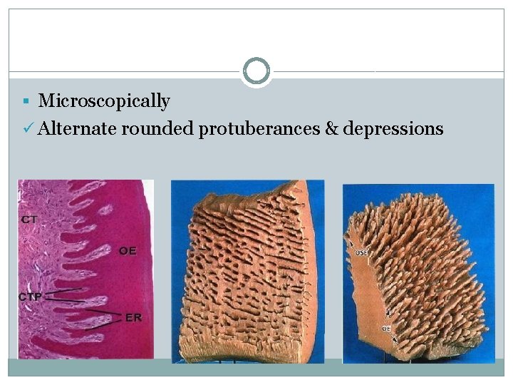 § Microscopically ü Alternate rounded protuberances & depressions 