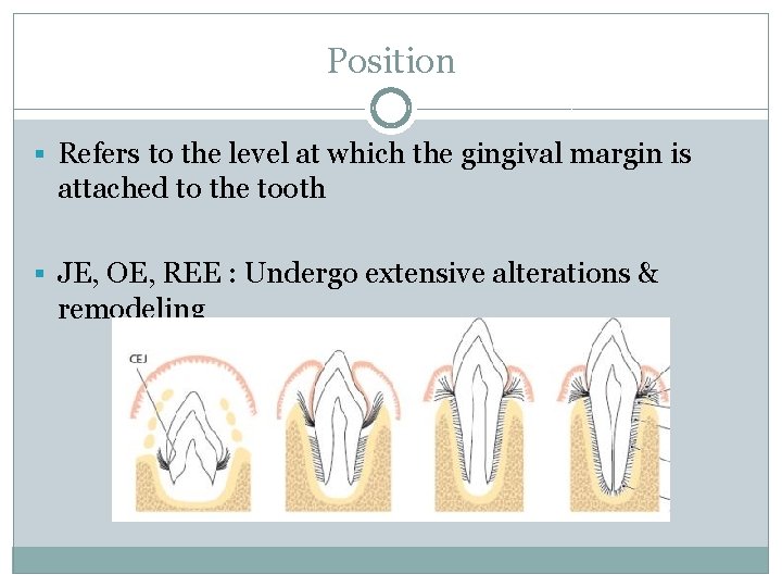 Position § Refers to the level at which the gingival margin is attached to