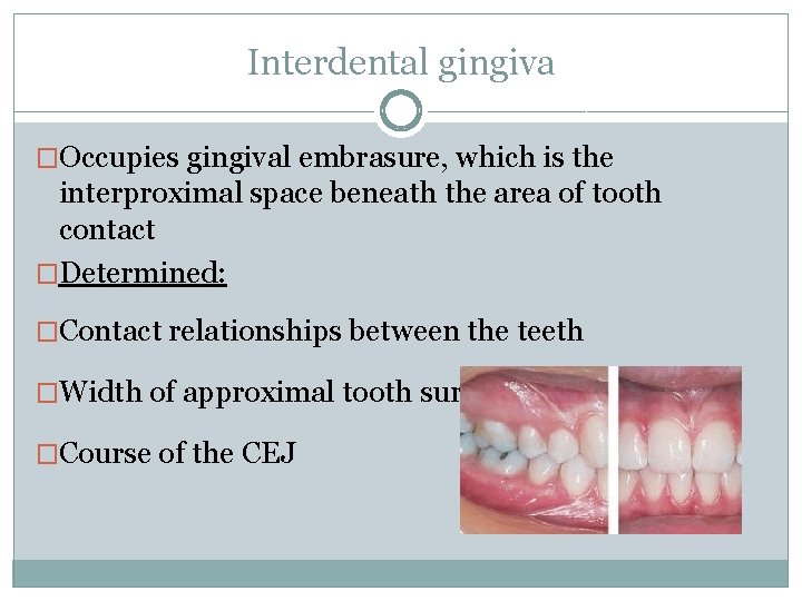 Interdental gingiva �Occupies gingival embrasure, which is the interproximal space beneath the area of