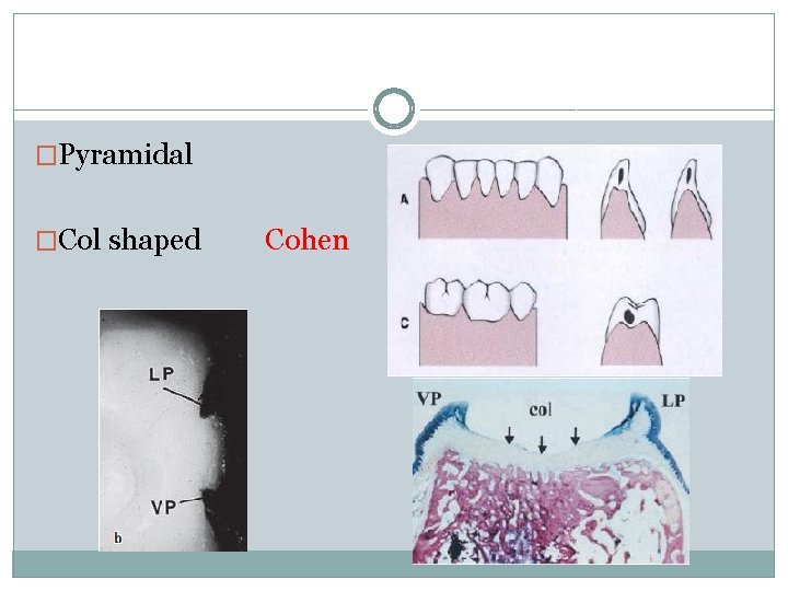 �Pyramidal �Col shaped Cohen 