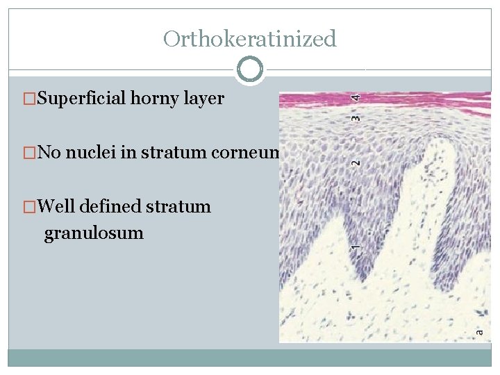 Orthokeratinized �Superficial horny layer �No nuclei in stratum corneum �Well defined stratum granulosum 