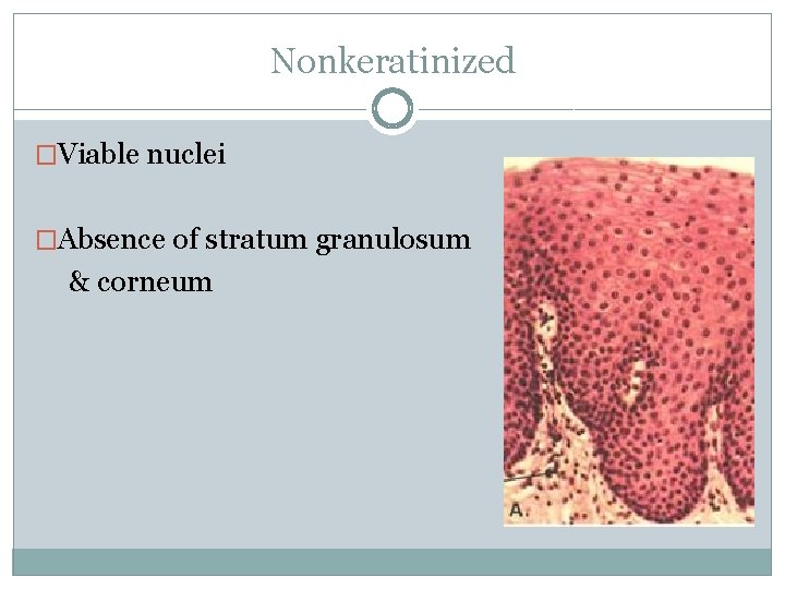 Nonkeratinized �Viable nuclei �Absence of stratum granulosum & corneum Nonkeratinized �Viable nuclei �Absence of stratum granulosum & corneum