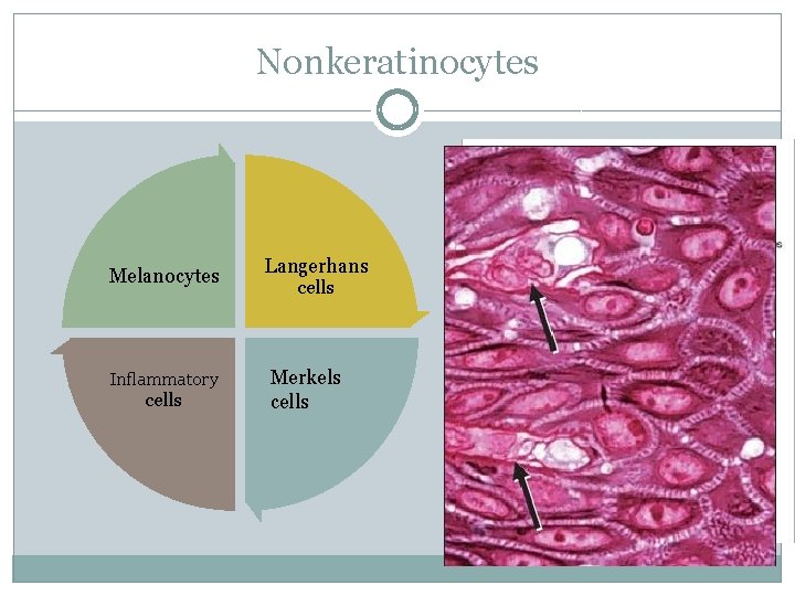 Nonkeratinocytes Melanocytes Inflammatory cells Langerhans cells Merkels cells 