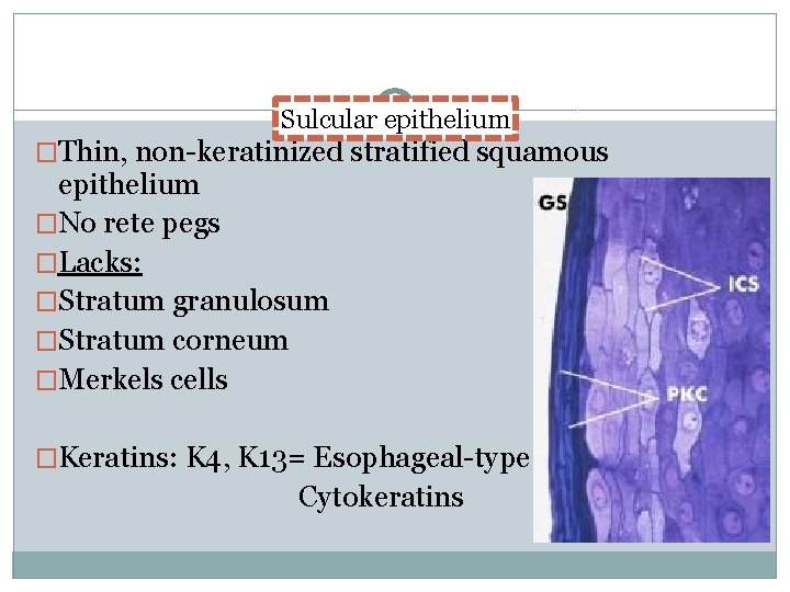 Sulcular epithelium �Thin, non-keratinized stratified squamous epithelium �No rete pegs �Lacks: �Stratum granulosum �Stratum