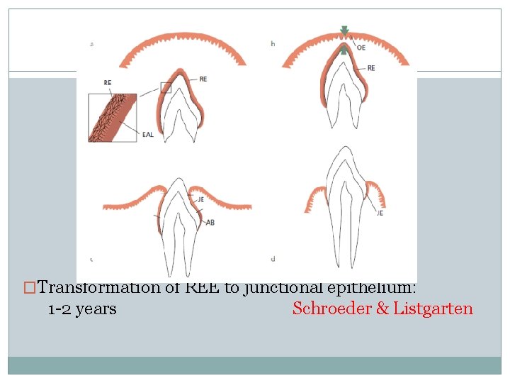 �Transformation of REE to junctional epithelium: 1 -2 years Schroeder & Listgarten 