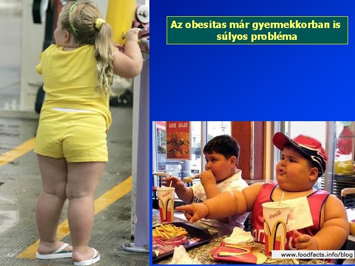 Az obesitas már gyermekkorban is súlyos probléma 