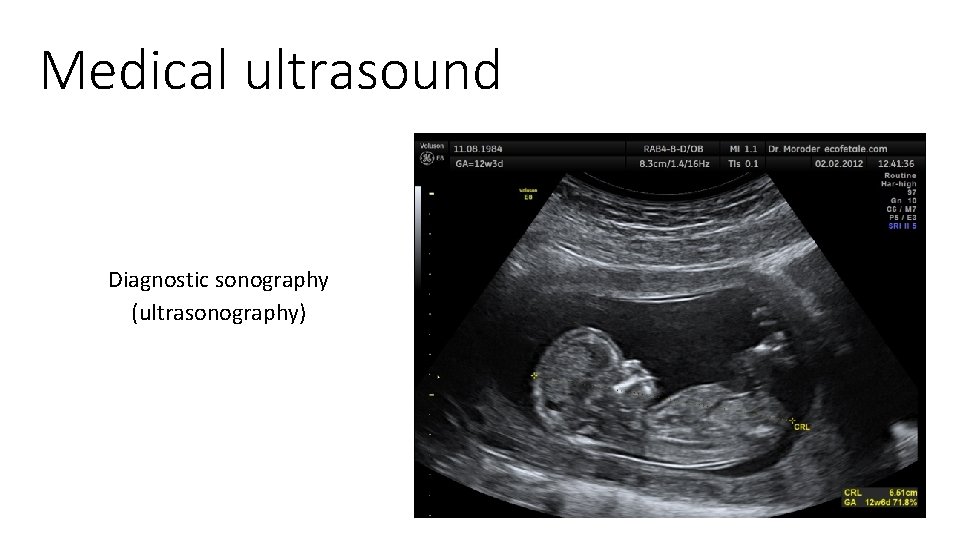 Medical ultrasound Diagnostic sonography ultrasonography Ultrasound and ...