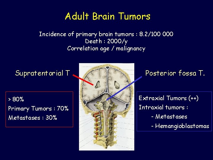 Adult Brain Tumors Incidence of primary brain tumors : 8. 2/100 000 Death :