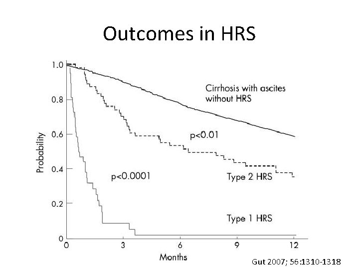 Outcomes in HRS Gut 2007; 56: 1310 -1318 