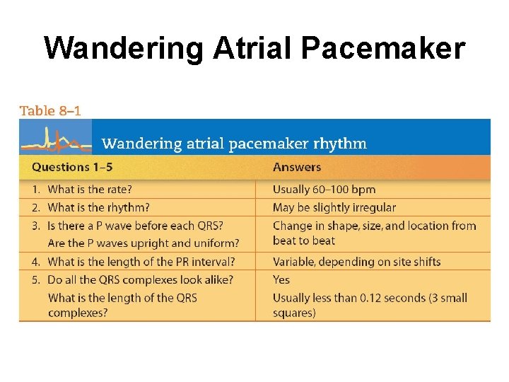 Wandering Atrial Pacemaker 