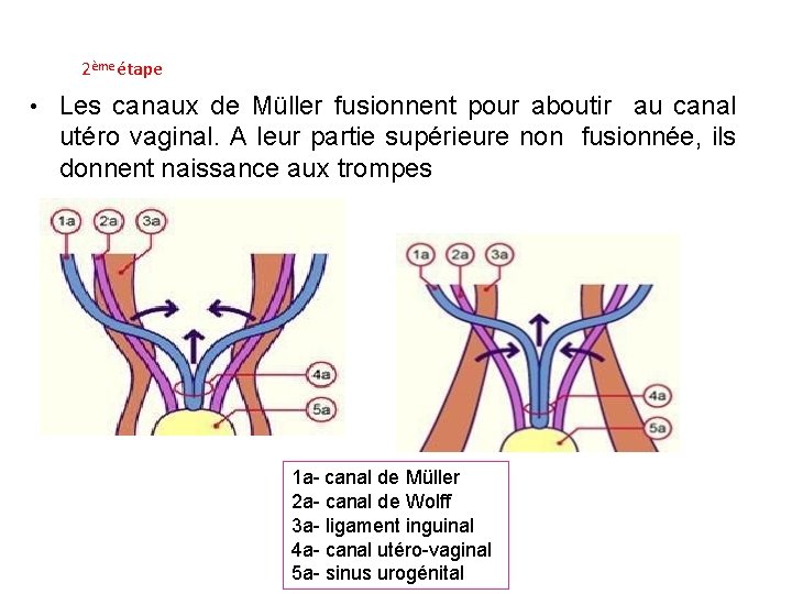 apport-de-lirm-dans-linfertilit-et-malformations-utrovaginales