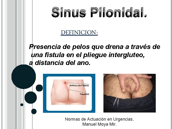PATOLOGIAS ANORRECTALES Dr Carlos E Gmez Salas R