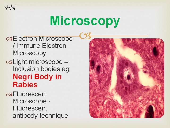 Microscopy Electron Microscope / Immune Electron Microscopy Light microscope – Inclusion bodies eg Microscopy Electron Microscope / Immune Electron Microscopy Light microscope – Inclusion bodies eg