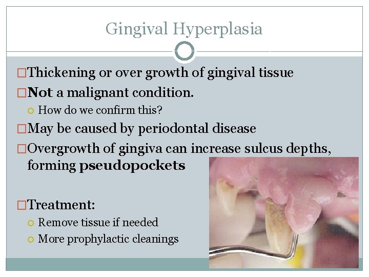 Gingival Hyperplasia �Thickening or over growth of gingival tissue �Not a malignant condition. How