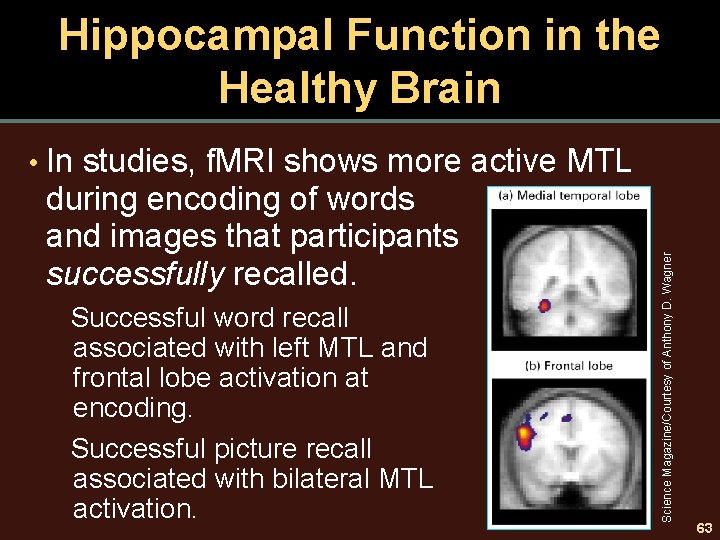  • In studies, f. MRI shows more active MTL during encoding of words