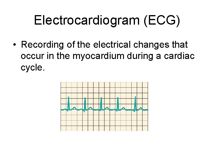 Electrocardiogram (ECG) • Recording of the electrical changes that occur in the myocardium during