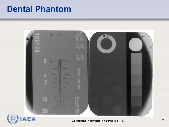 Dental Phantom IAEA 22: Optimization of Protection in Dental Radiology 33 