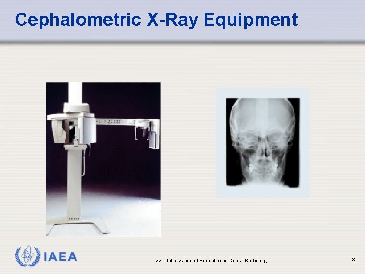 Cephalometric X-Ray Equipment IAEA 22: Optimization of Protection in Dental Radiology 8 