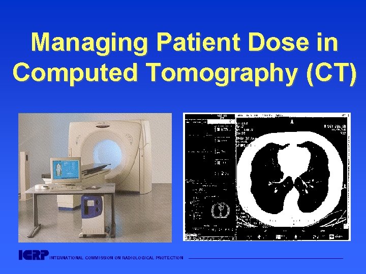 Managing Patient Dose in Computed Tomography (CT) INTERNATIONAL COMMISSION ON RADIOLOGICAL PROTECTION ——————————————————— 