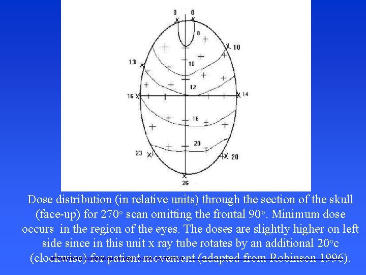 Dose distribution (in relative units) through the section of the skull (face-up) for 270