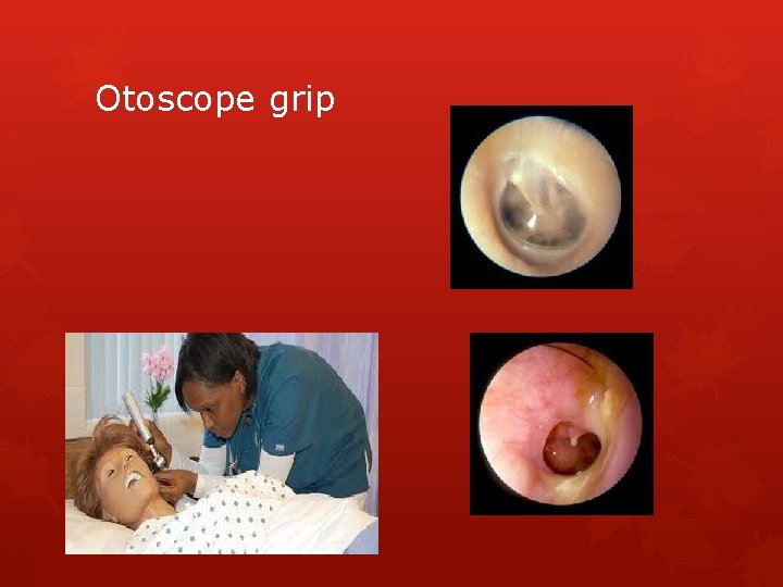 Otoscope grip 