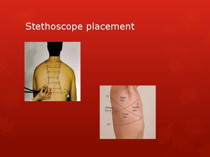 Stethoscope placement 