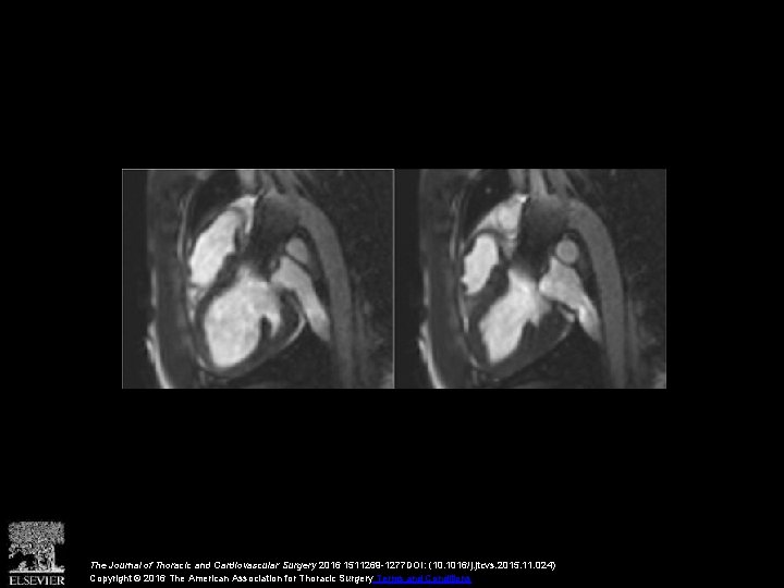 The Journal of Thoracic and Cardiovascular Surgery 2016 1511269 -1277 DOI: (10. 1016/j. jtcvs.