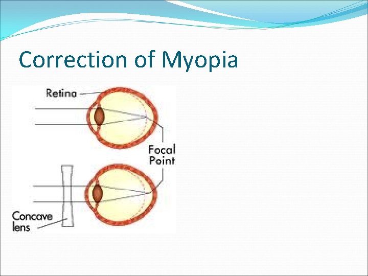 Vision and Vision Problems 3 Os Optometrist Opthalmologist