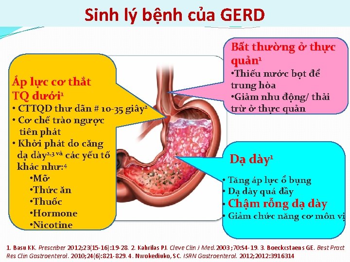 Sinh lý bệnh của GERD Bất thường ở thực quản 1 Áp lực cơ