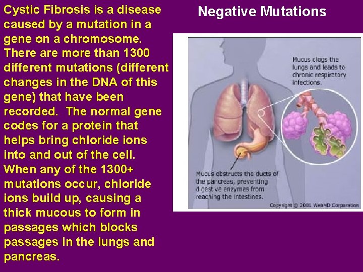 Cystic Fibrosis is a disease caused by a mutation in a gene on a
