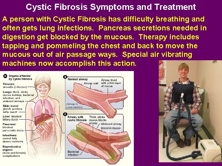 Cystic Fibrosis Symptoms and Treatment A person with Cystic Fibrosis has difficulty breathing and