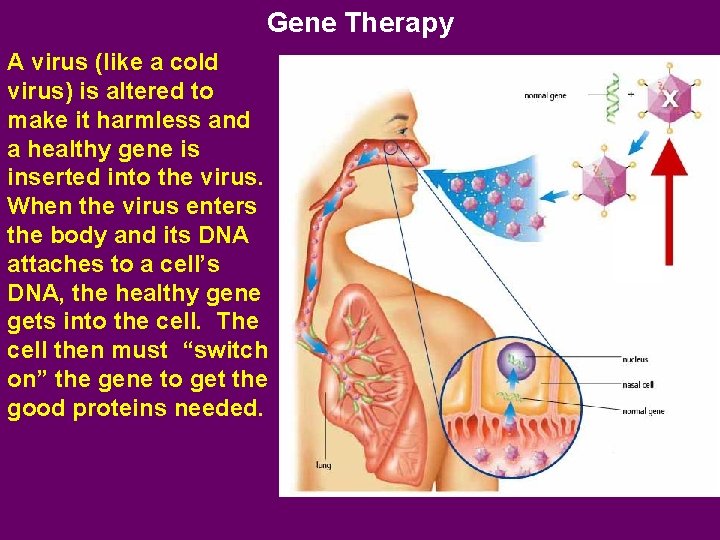 Gene Therapy A virus (like a cold virus) is altered to make it harmless