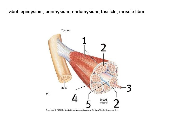 Label: epimysium; perimysium; endomysium; fascicle; muscle fiber 