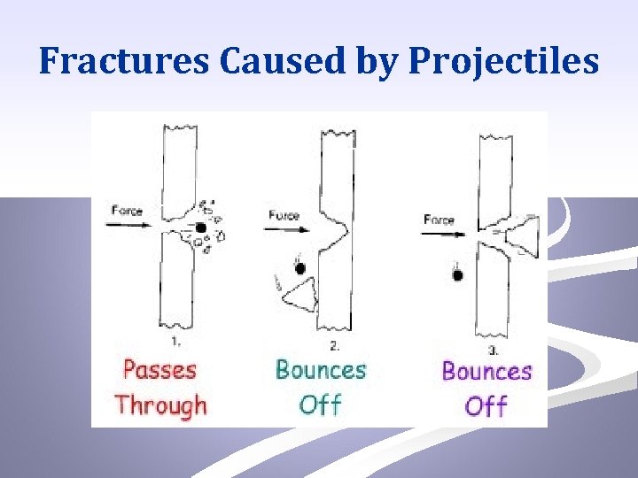 Fractures Caused by Projectiles 