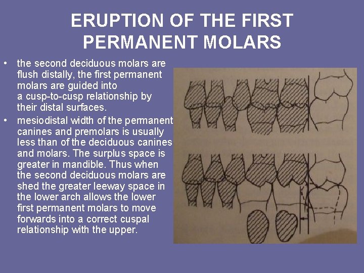 ERUPTION OF THE FIRST PERMANENT MOLARS • the second deciduous molars are flush distally, ERUPTION OF THE FIRST PERMANENT MOLARS • the second deciduous molars are flush distally,