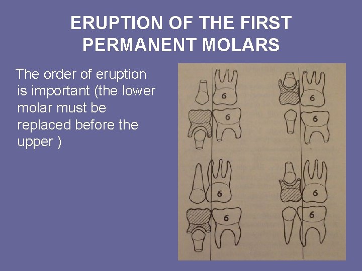 ERUPTION OF THE FIRST PERMANENT MOLARS The order of eruption is important (the lower ERUPTION OF THE FIRST PERMANENT MOLARS The order of eruption is important (the lower