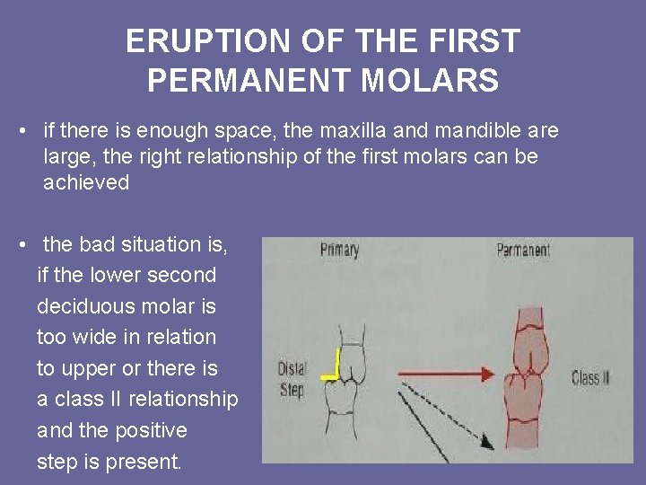 ERUPTION OF THE FIRST PERMANENT MOLARS • if there is enough space, the maxilla ERUPTION OF THE FIRST PERMANENT MOLARS • if there is enough space, the maxilla