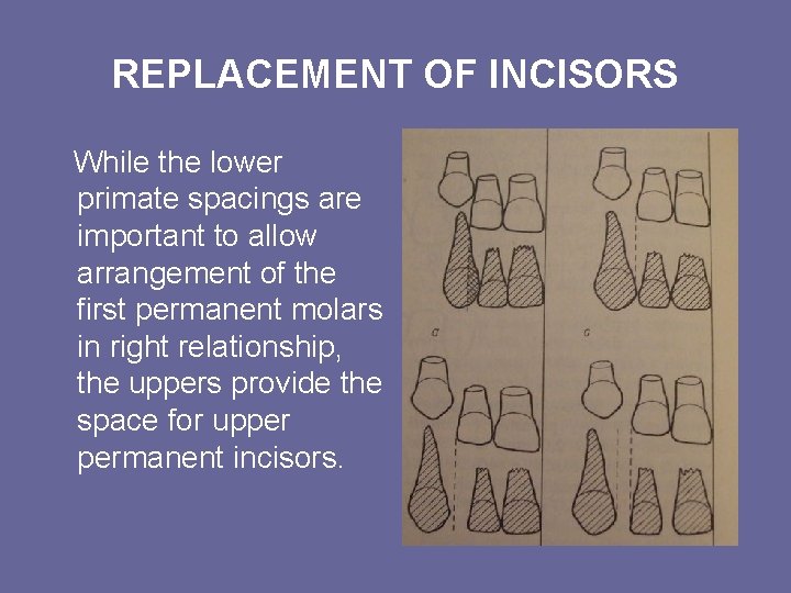 REPLACEMENT OF INCISORS While the lower primate spacings are important to allow arrangement of REPLACEMENT OF INCISORS While the lower primate spacings are important to allow arrangement of