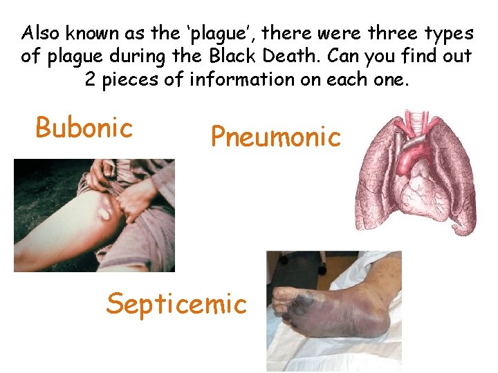Also known as the ‘plague’, there were three types of plague during the Black