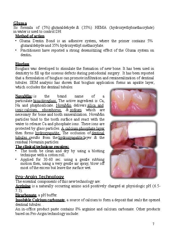 Gluma Its formula of (5%) glutaraldehyde & (35%) HEMA (hydroxyethylmethacrylate) in water is used Gluma Its formula of (5%) glutaraldehyde & (35%) HEMA (hydroxyethylmethacrylate) in water is used