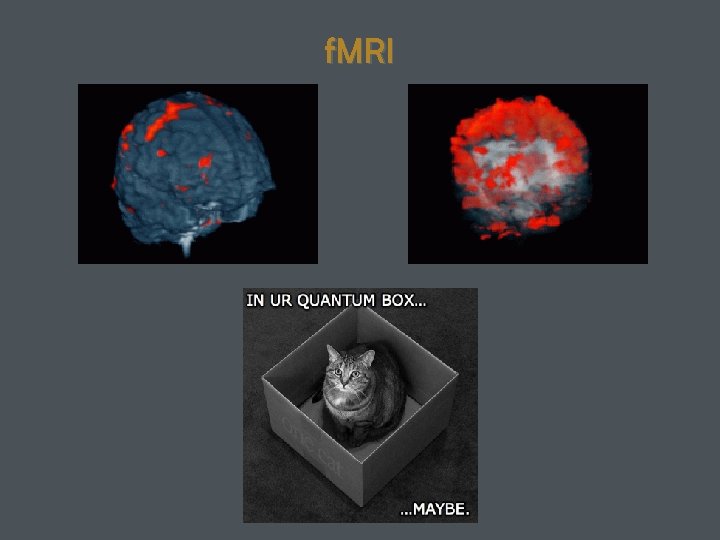 f. MRI 