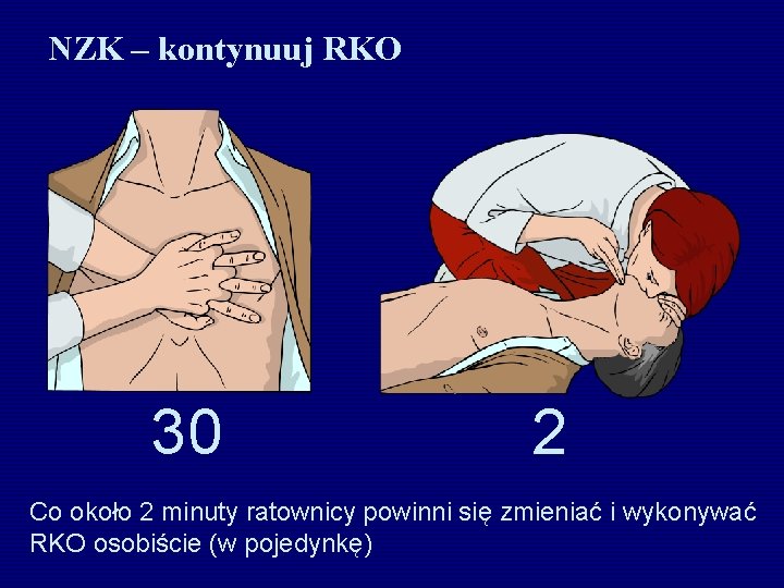 NZK – kontynuuj RKO 30 2 Co około 2 minuty ratownicy powinni się zmieniać
