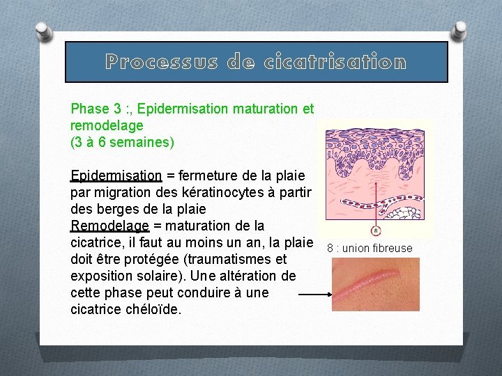 Processus de cicatrisation Phase 3 : , Epidermisation maturation et remodelage (3 à 6 Processus de cicatrisation Phase 3 : , Epidermisation maturation et remodelage (3 à 6