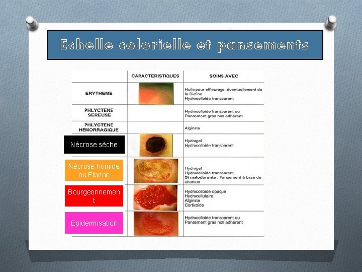Echelle colorielle et pansements Nécrose sèche Nécrose humide ou Fibrine Bourgeonnemen t Epidermisation Echelle colorielle et pansements Nécrose sèche Nécrose humide ou Fibrine Bourgeonnemen t Epidermisation