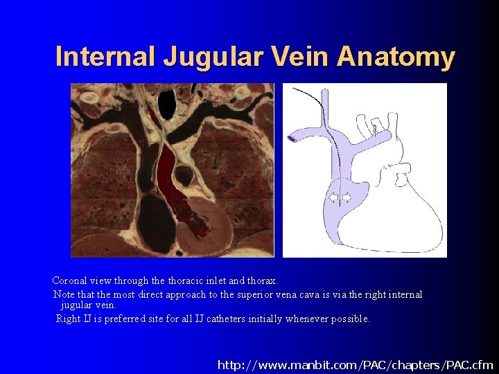 Internal Jugular Vein Anatomy Coronal view through the thoracic inlet and thorax. Note that